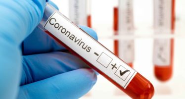 Se registra en RD 515 nuevos contagios por COVID-19 en último informe
